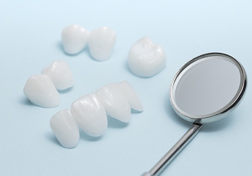 Different types of porcelain veneers before placement