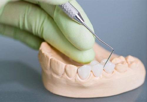 A technician working on a traditional dental bridge