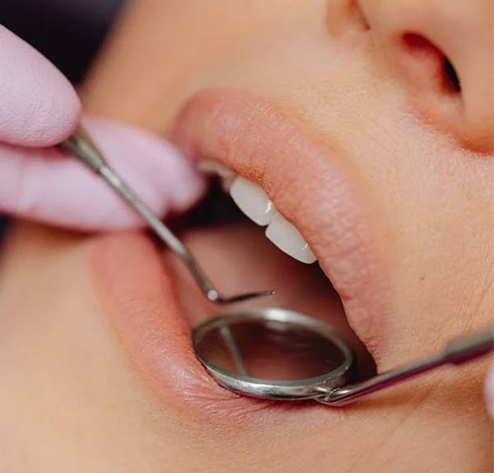 Close up of dentist examining woman’s mouth