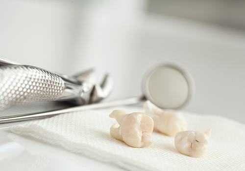 Extracted teeth on napkin next to forceps and mirror