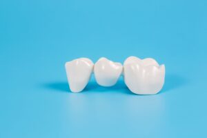 Closeup of a small dental bridge on a light blue surface